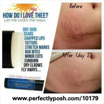 Fade Stretch Marks with the Healer Skin Stick From Perfectly Posh https://apamperedlife.wordpress.com/2016/08/04/beauty-review-facemask/